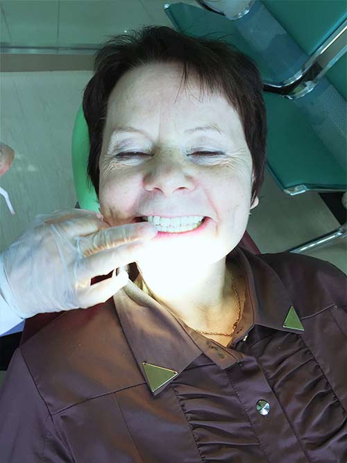 фото пациента стоматологии ченгши