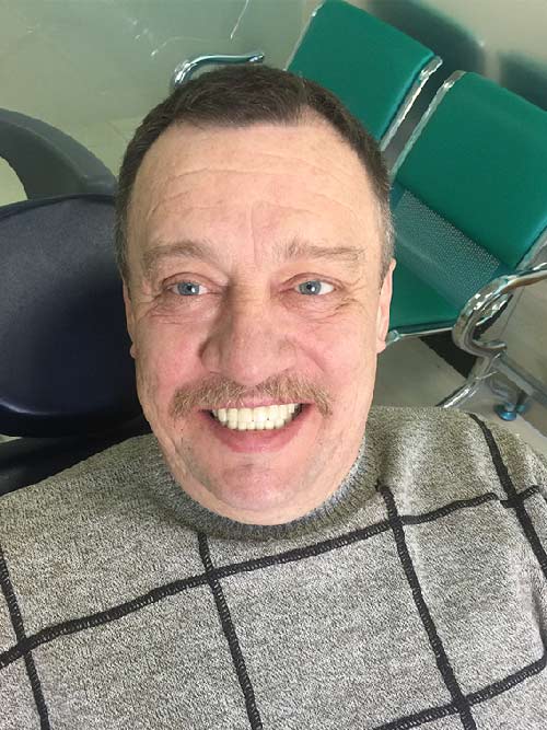 фото пациента стоматологии ченгши